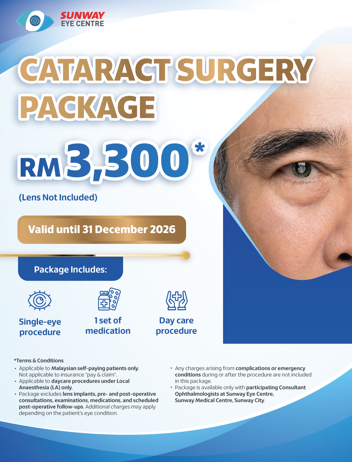 Cataract Surgery Package